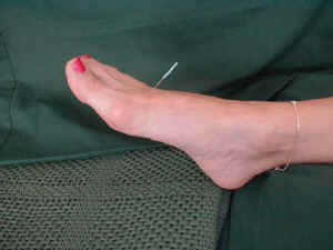 foot_1.jpg (41982 bytes)